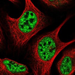 AP5Z1 Antibody, Novus Biologicals 0.1mL; Unlabeled:Antibodies, Polyclonal